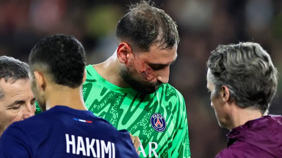 Futbol maçı mı kafes dövüşü mü? Donnarumma'nın suratı paramparça oldu 3