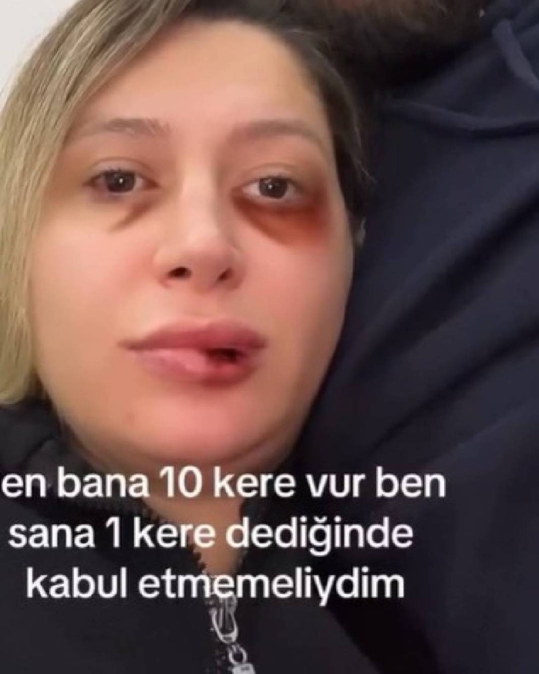 Neşe Özkan kimdir nereli kaç yaşında evli mi çocuk sahibi mi neden öldü? 2