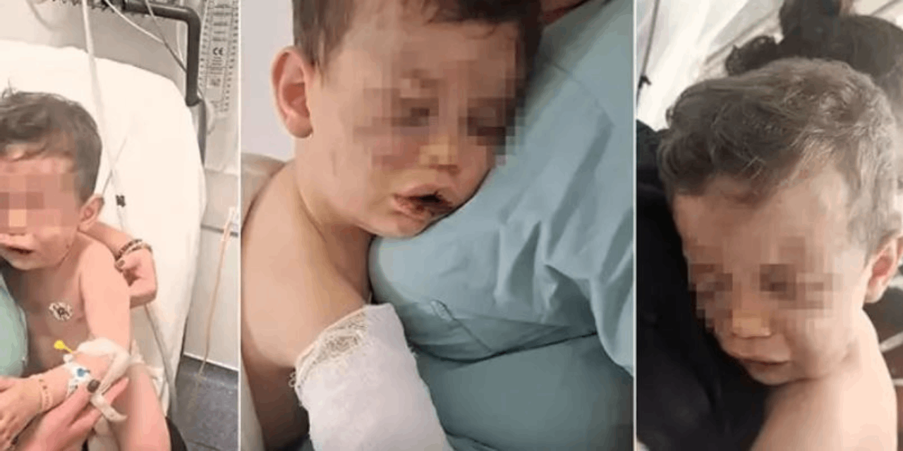 2 yaşındaki çocuğa kabusu yaşattı: Annesinin sevgilisi tarafından öldüresiye dövüldü