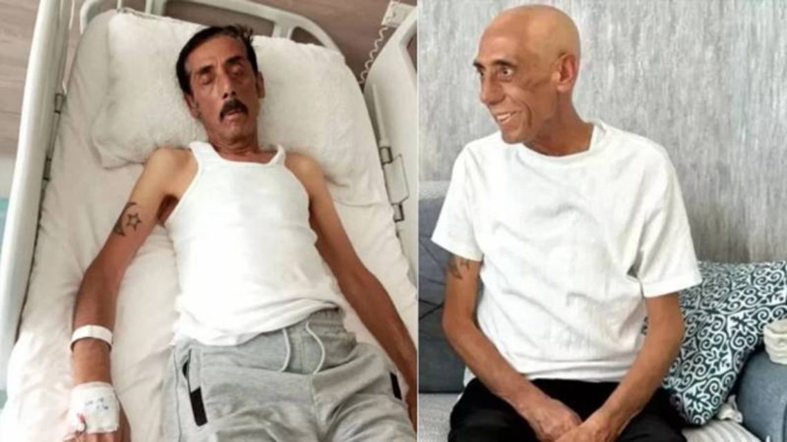 Ankaralı Turgut'un kızı açıkladı: Tedavisi yoğun bakımda devam ediyor