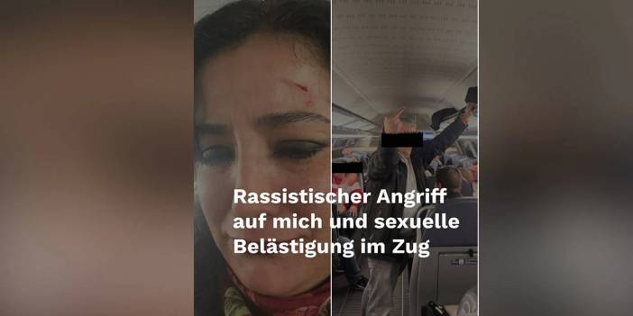 Sol Partili milletvekiline ırkçı saldırı: Taraftarların arasında kaldı