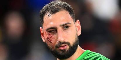 Futbol maçı mı kafes dövüşü mü? Donnarumma'nın suratı paramparça oldu