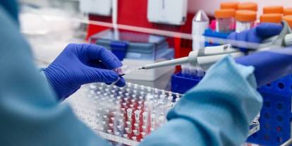 DNA testiyle ortaya çıkan korkunç tesadüf: Evli çift kardeş olduklarını öğrendi