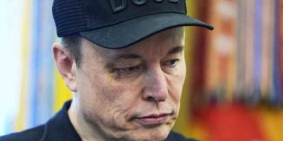 Elon Musk gözündeki morluğun nedenini açıkladı