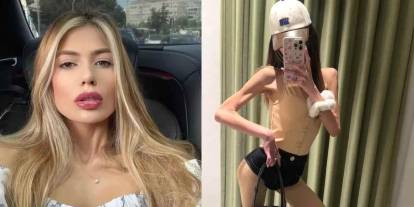 Anoreksiya nervoza nedeniyle 23 kiloya kadar düşmüştü: Nihal Candan yaşamını yitirdi